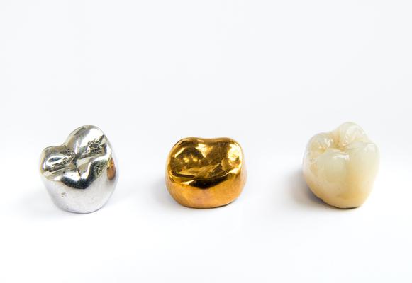 3 types of dental crowns offered by Dentistry At The Grove