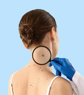 Image of Lotus Skin Check Clinic