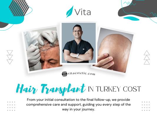 Hair Transplant in Turkey Cost