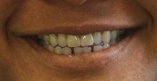 Image of Northville Smiles