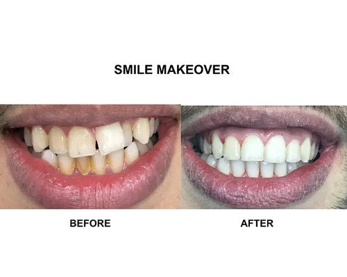 Image of Dental Perfection Coventry