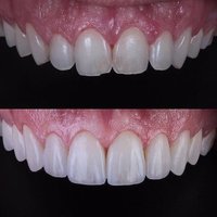 Image of Emergency Dentist Bucks County