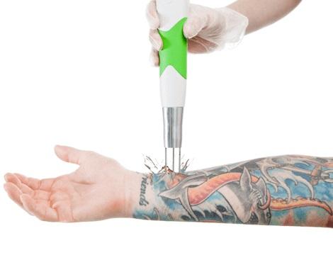 Image of Think Again Laser Clinic – Auckland