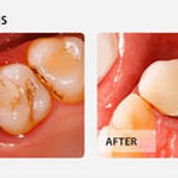 Image of Emergency Dental NE Philadelphia