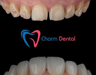 Image of Charm Dental - Humble