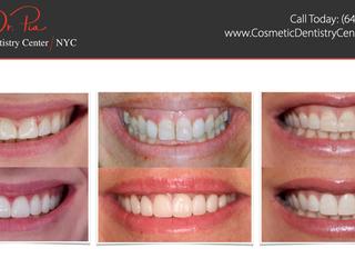 Image of Cosmetic Dentistry Center NYC