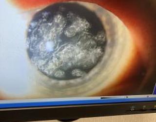 Image of Eye Associates