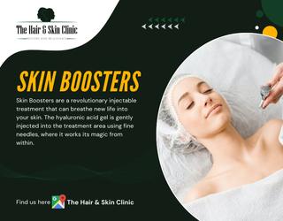 Skin Boosters