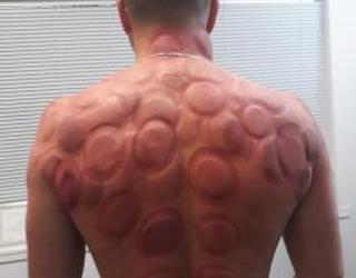 Image of Physio Connect Birkenhead