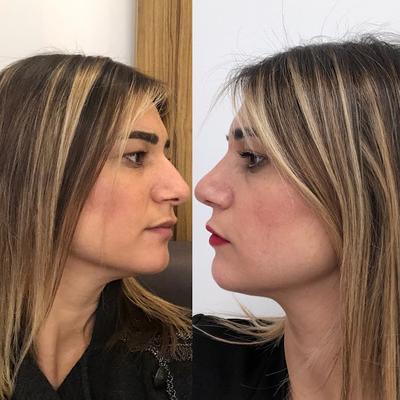 Image of Este Hair Medical London
