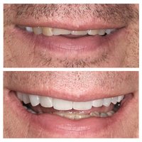 Image de A Smile Above