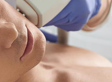 Acne Clearing Treatment for Men’s Skin