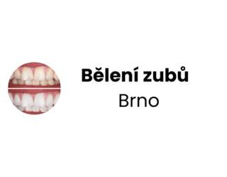Obraz Bělení zubů Brno
