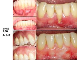 Image of IMPrESS Perio Implant Center| Certified Specialists