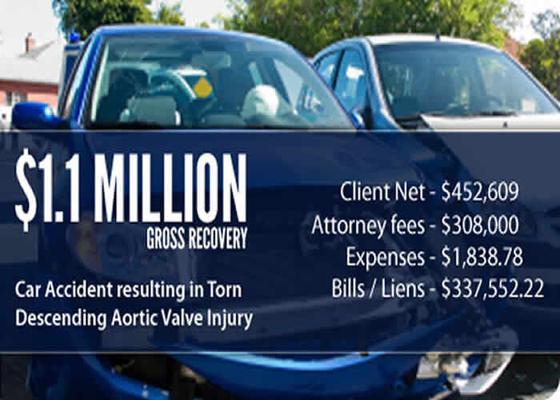 $1,100,000 Settlement for Client Injured in Car Accident