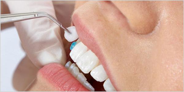 Image of Maroubra Dental Avenue