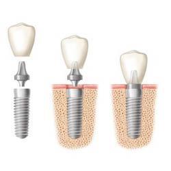 Image of DENTAL IMPLANT PROFESSIONALS Sydney