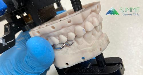 Image de Summit Denture Clinic