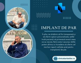 Implant De Par