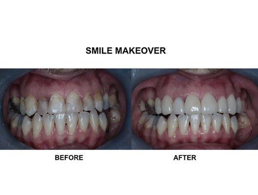 Image of Dental Perfection Coventry