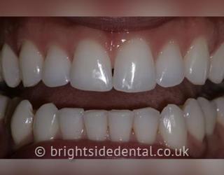 Image of Brightside Dental