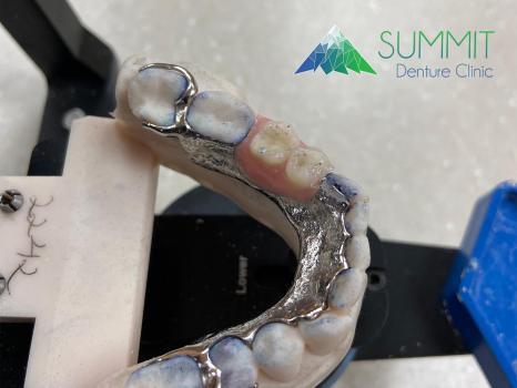 Image de Summit Denture Clinic