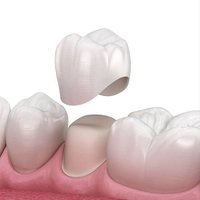 Image of Emergency Dentist Bucks County