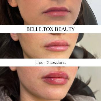 Image de Belle.tox Beauty