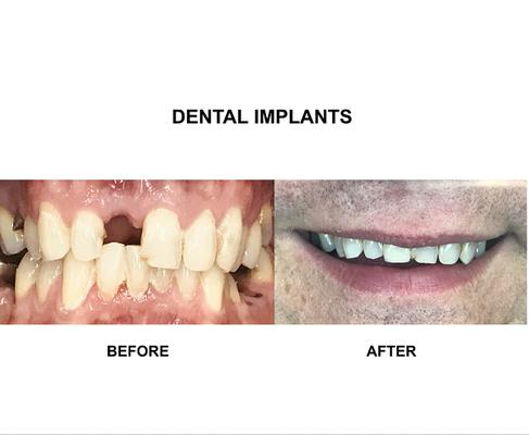 Image of Dental Perfection Coventry