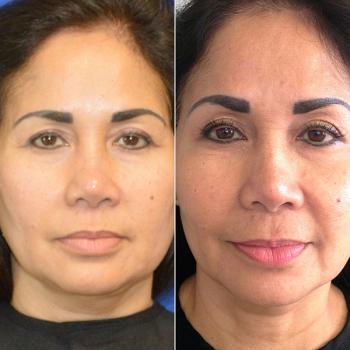 Image of Indulgence Cosmetics & Skincare Clinic