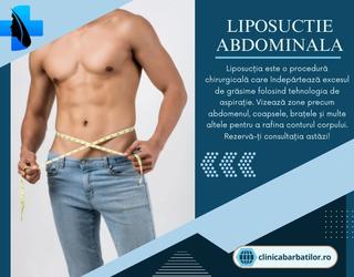 Liposuctie Abdominala