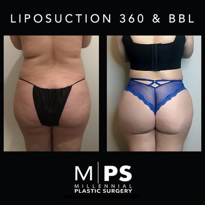 Image of Millennial Plastic Surgery