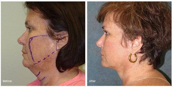 Image of Belmont Plastic Surgery