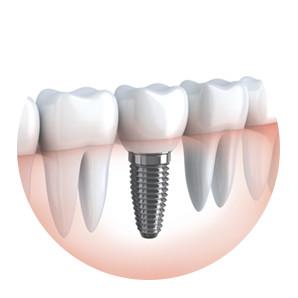 Image of Wisdom Teeth Professionals