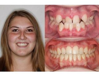 Image of Silcox Orthodontics
