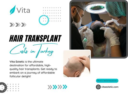 Hair Transplant Costs in Turkey