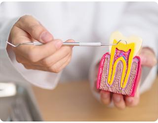 Root Canal Springvale