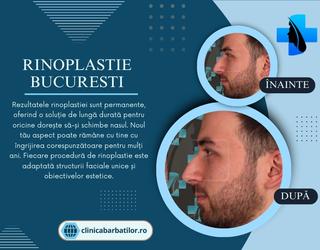 Rinoplastie Bucuresti