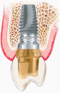 Image of National Periodontics