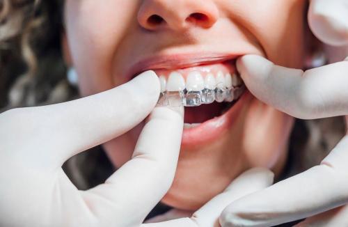 Image of Your Smile