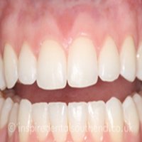 Inspire Dental Southend  photo