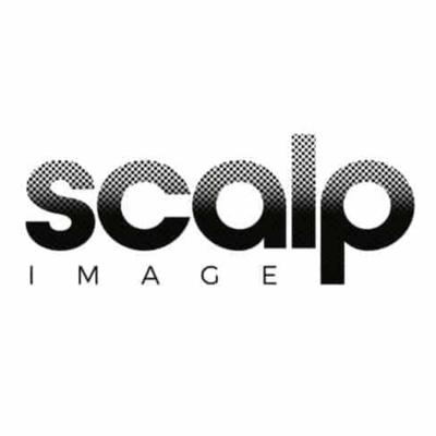 Image of Scalp Image