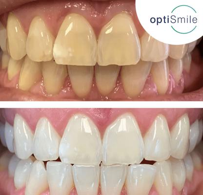 Afbeelding van OptiSmile Advanced Dentistry and Implant Centre