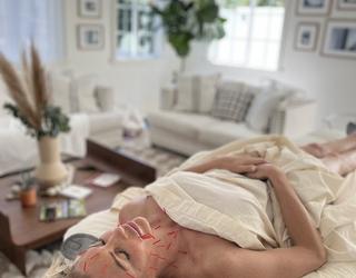 Image of California Mobile Acupuncture