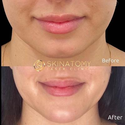 Skinatomy Laser Clinic