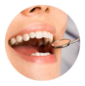 Image of Wisdom Teeth Professionals