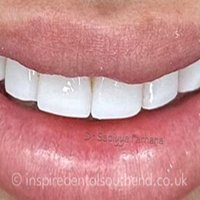 Inspire Dental Southend  photo