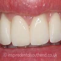 Inspire Dental Southend  photo