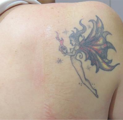 Image of Think Again Laser Clinic – Auckland