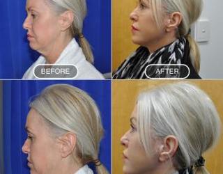 Image of Sydney Plastic Surgery